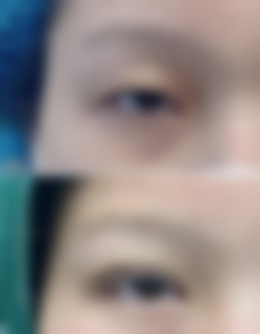 温州伯思立医院整形外科口碑好不好?附真实患者口碑评价