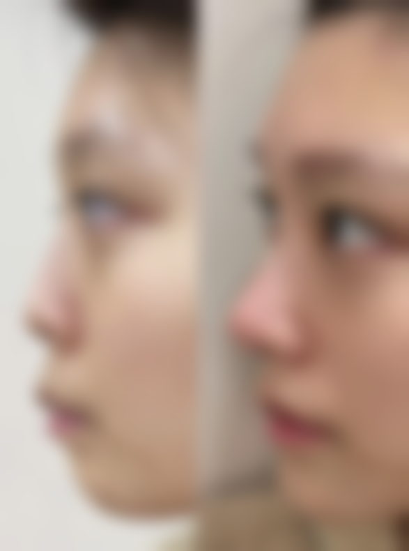 温州伯思立医院整形外科地址及乘车路线