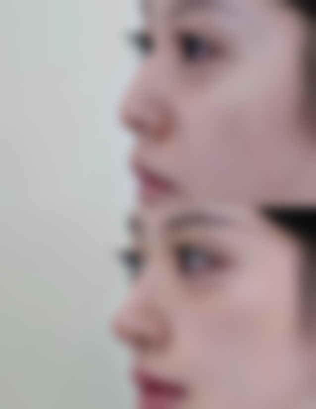 黑龙江博爱医院美容整形中 心价格表