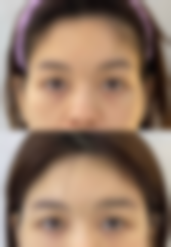 崔圭镇医生做手术价格