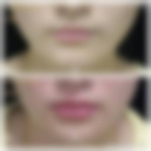 西安星颜靓影医疗美容诊所怎么样，评价