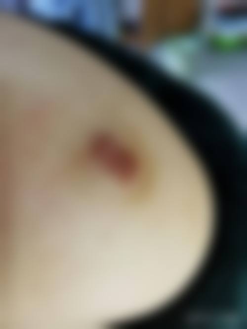 重庆鹏爱医疗美容整形怎么样，口碑好不好