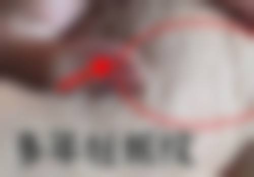 重庆鹏爱医疗美容整形怎么样，正规吗