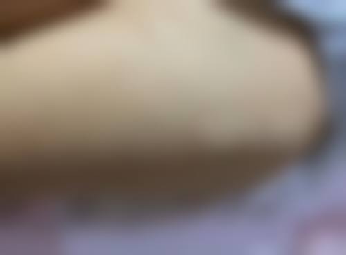 西安星颜靓影医疗美容诊所怎么样，更擅长什么手术