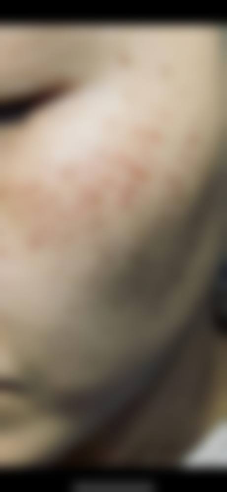 南方医 科 大学南方医院赖宽医生项目优势