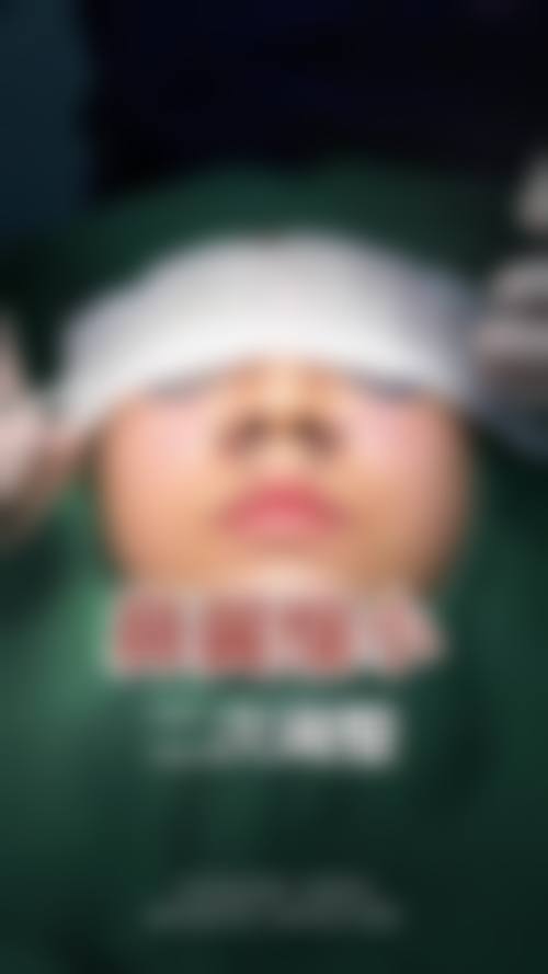 张明兴医生口碑如何