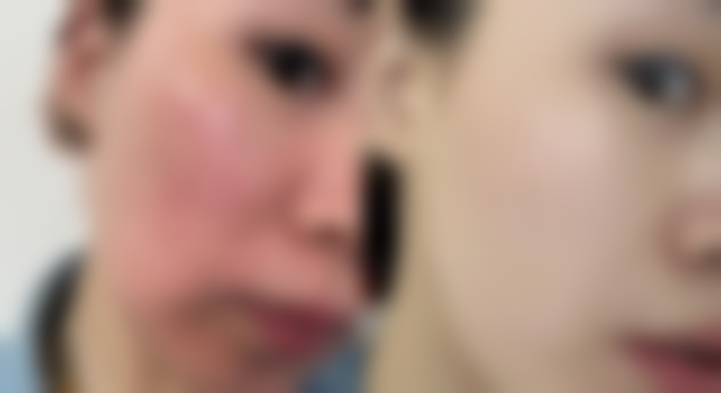 张章医生简介做手术价格