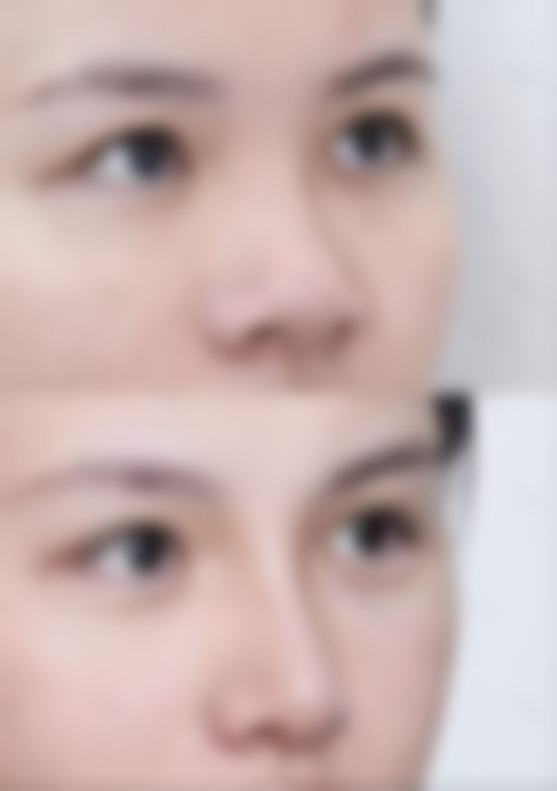 沈阳斯美诺整形医院项目特色