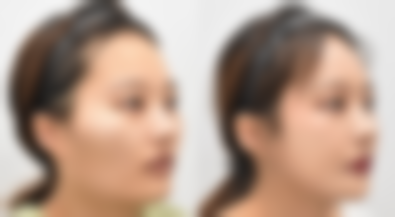 央金医生做手术价格