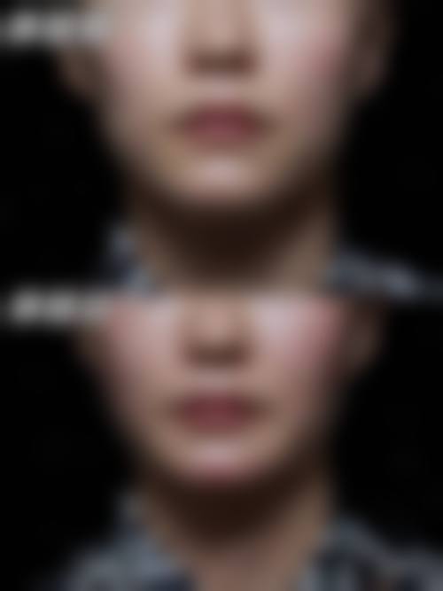 四、昭通灿妍整形医院怎么样项目特色