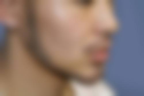 深圳黛颜医疗美容医院口碑好不好？附真实患者口碑评价