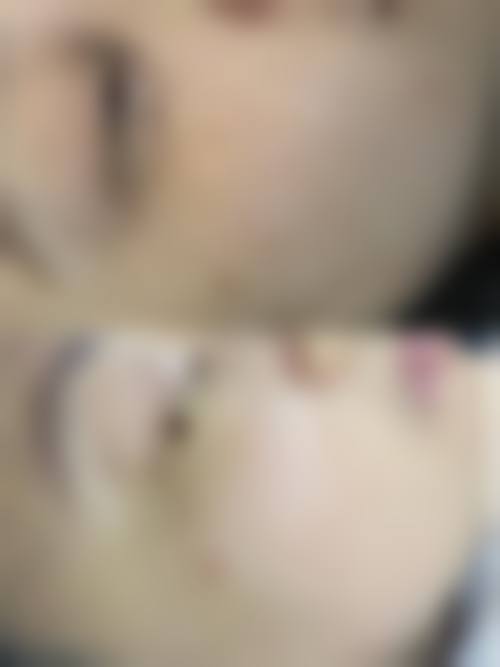 兰州圣莫丽斯美容门诊部顾客实例