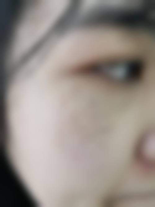 西安赫本医疗美容门诊部更擅长什么