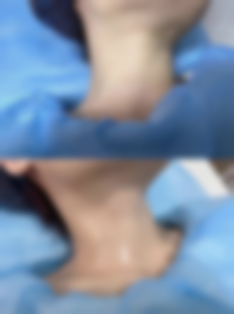 武汉德恩医疗美容门诊抖音团购活动有哪些，价格表