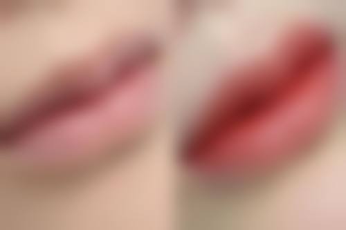 石嘴山市第二人民医院烧伤整容中 心价格表