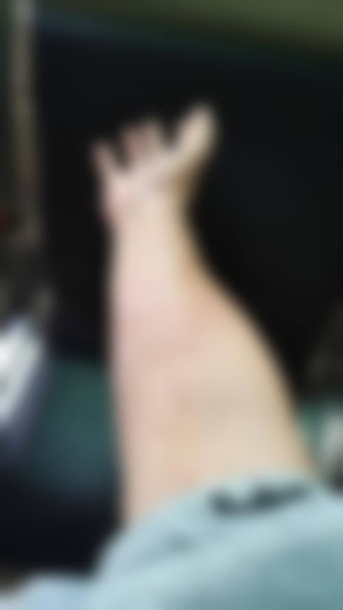 桂林医学校附属医院(烧伤创面整形外科、医学美容外科)口碑好不好?附真实患者口碑评价