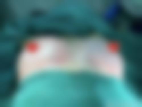 厦门原肌美塑滨东整形医院口碑好不好?附真实患者口碑评价