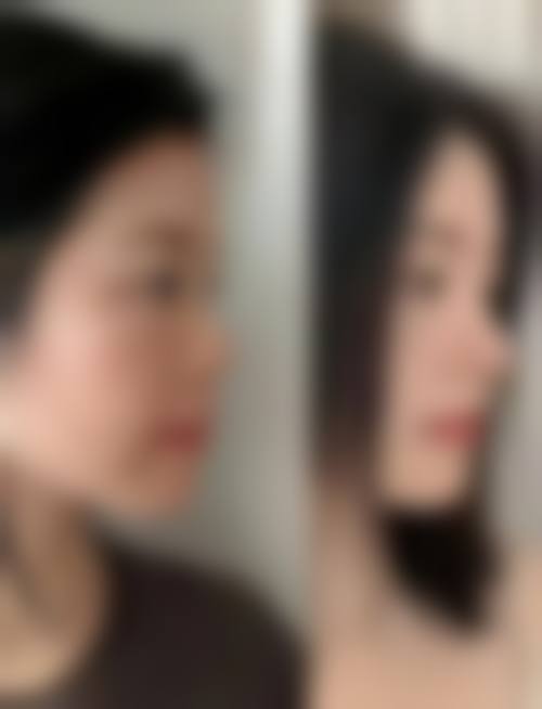 厦门原肌美塑滨东整形医院价格表