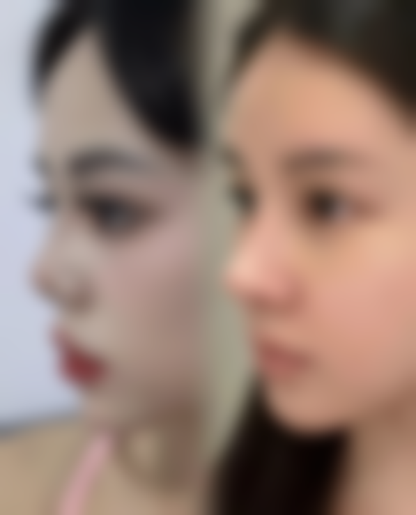 石嘴山市第二人民医院烧伤整容中 心地址及乘车路线