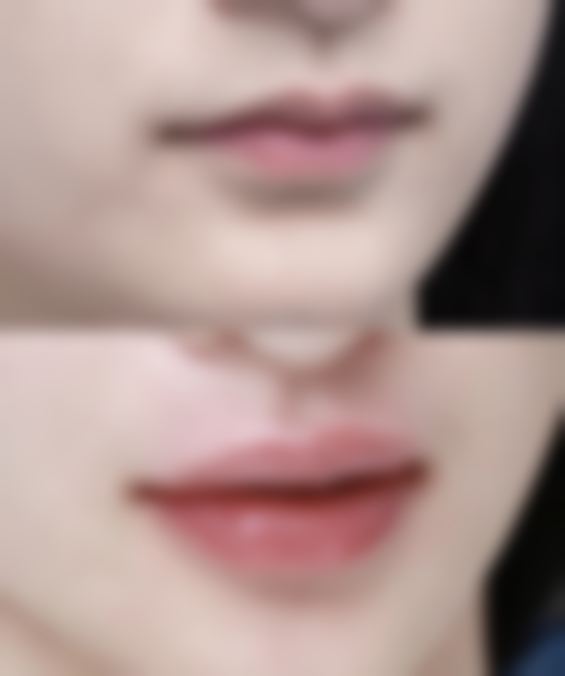 八、北京润颜医疗美容门诊部怎么样，价格表是怎样的