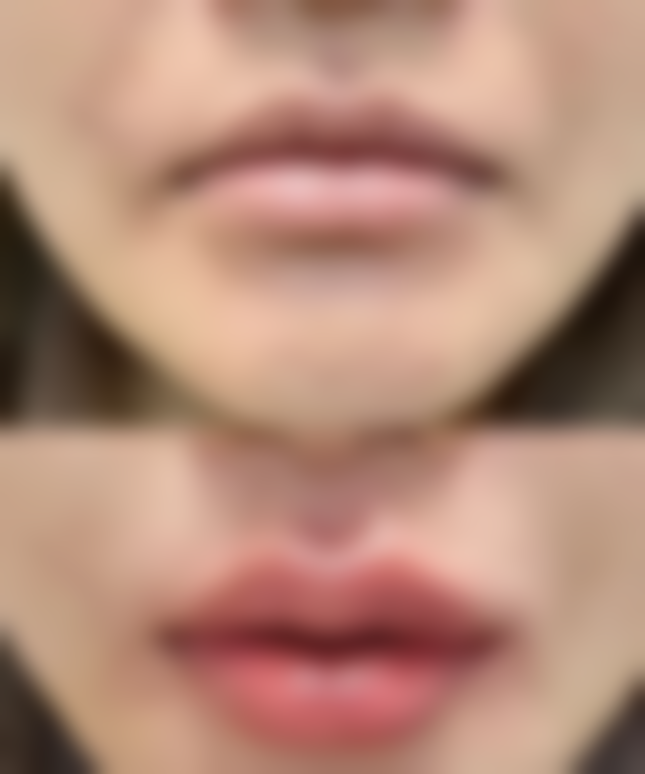 邓菲菲医生简介怎么挂号