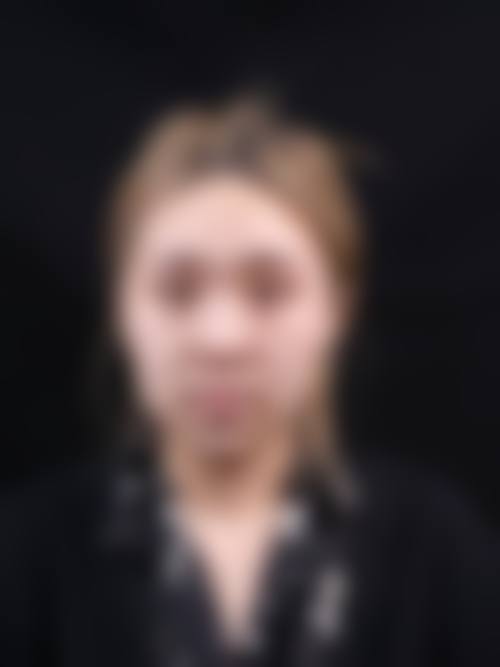 余昌胜医生简介做手术价格