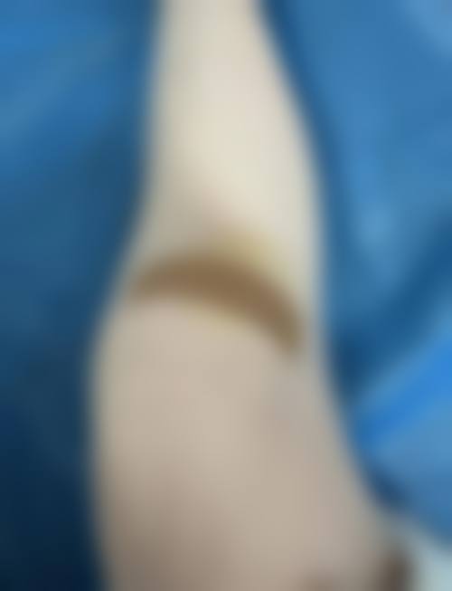 余昌胜医生简介项目优势