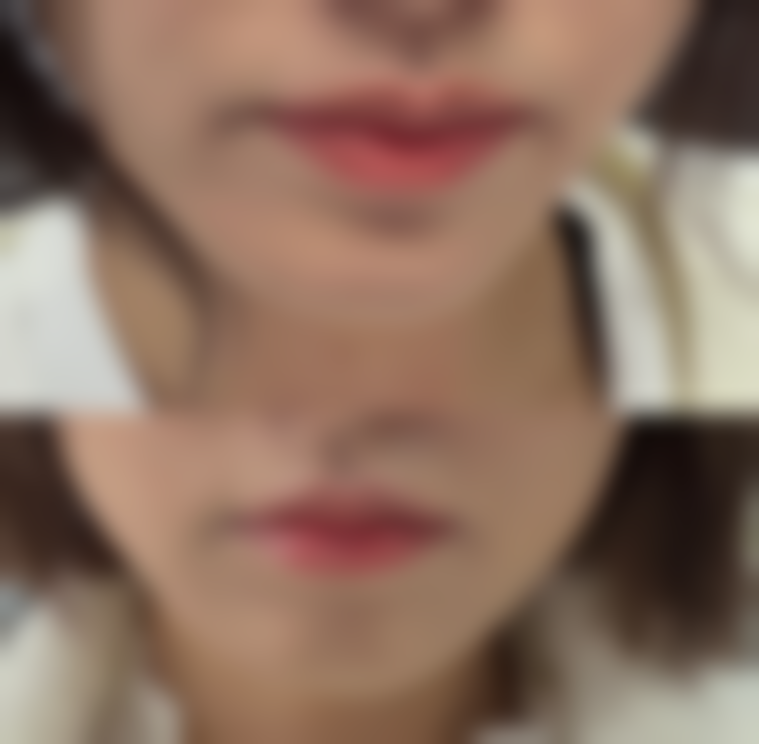 韩国德丽珍整形外科口碑好不好