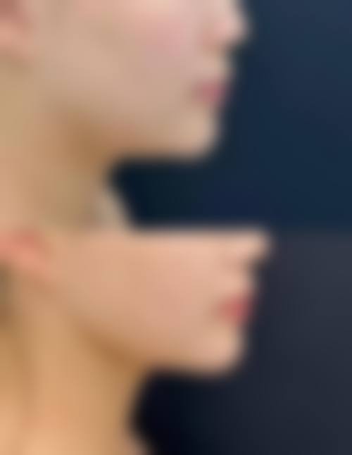 昆明医 科 大学第二附属医院整形外科地址及乘车路线