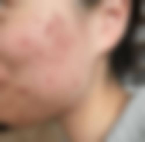 泰安聚丽整形医院口碑评价如何