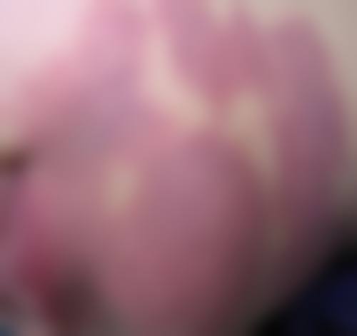 八、汕头国瑞医院整形外科价格表