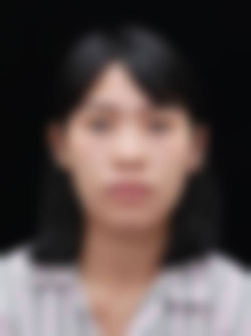 昆明医 科 大学第二附属医院整形外科口碑评价如何