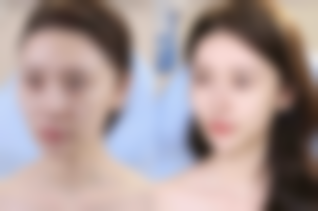 大同雨轩美容整形外科诊所怎么样，评价