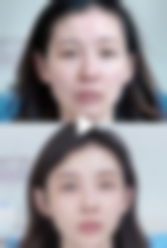 宁波江东邬立新医疗美容诊所价格表