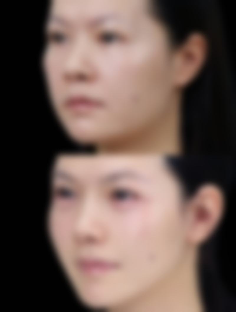 宁波江东邬立新医疗美容诊所可靠吗