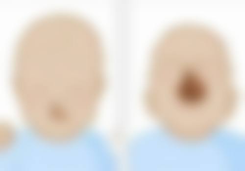 Dr.Akila医生做手术价格详情