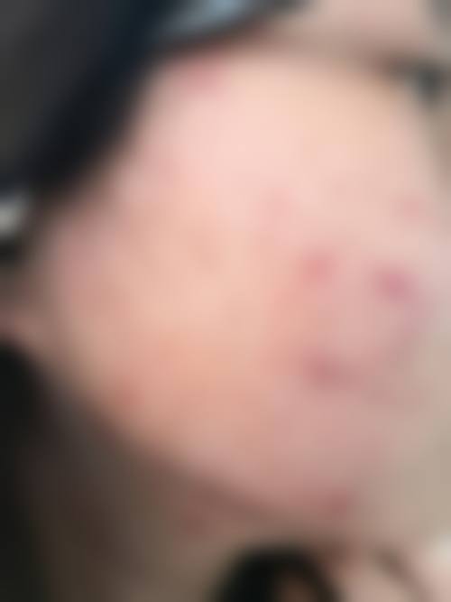 河南平顶山华薇医疗美容门诊部更擅长什么