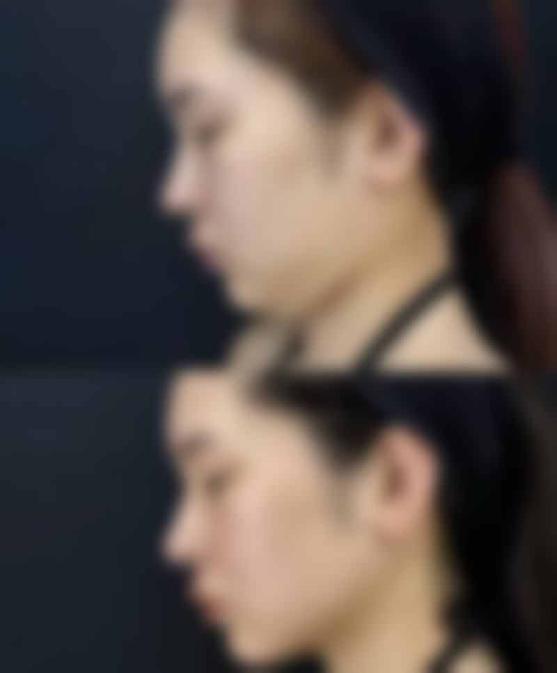 钟剑锋医生简介做手术价格参考