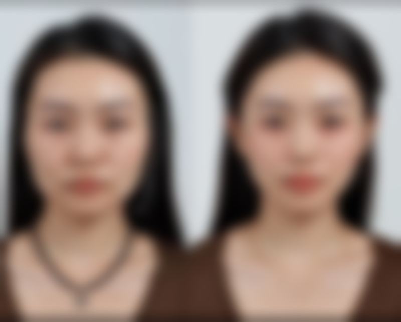 梁利荣医生简介项目优势