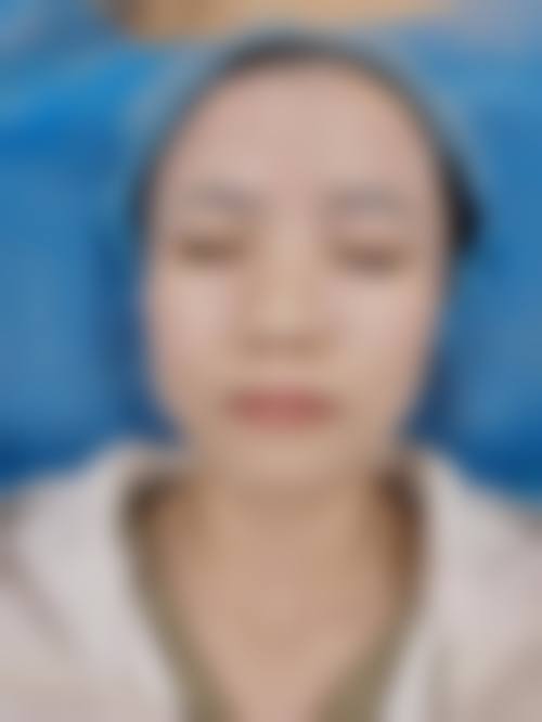 广州南方燕岭医院整形美容口碑评价