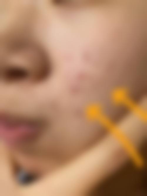 鞍山任凌欣医疗美容诊所怎么样，怎么挂号，地址在哪儿