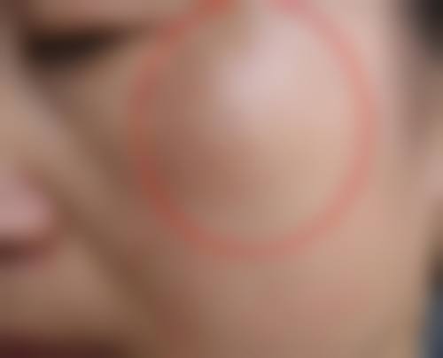 王立英医生简介项目优势