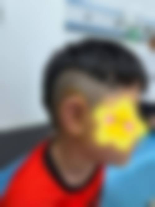 福州米兰植发医学美容医院口碑好不好