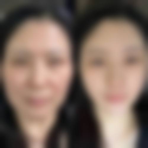 淮北铭一整形医院口碑好不好?附真实患者口碑评价