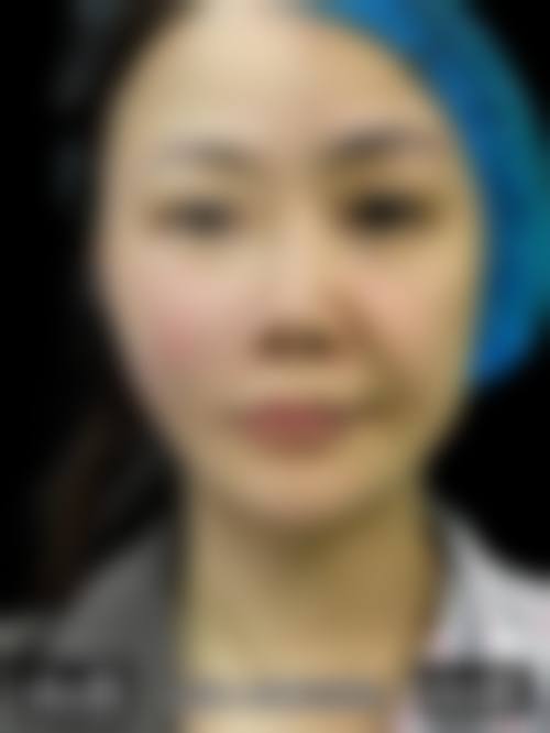 天津甜橙美陈医疗美容诊所怎么样更擅长什么