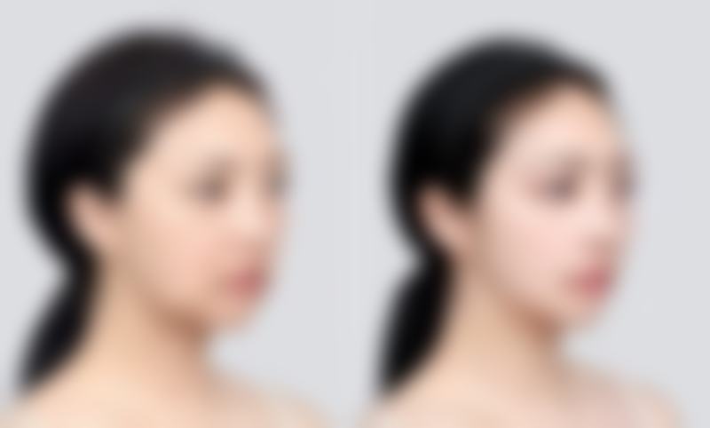 孔华斌医生顾客实例图片