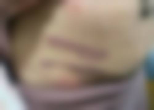 孙奎医生项目优势