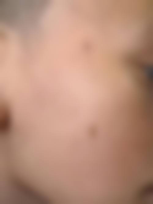 七、开原星禾整形医院口碑好不好？附真实患者口碑评价