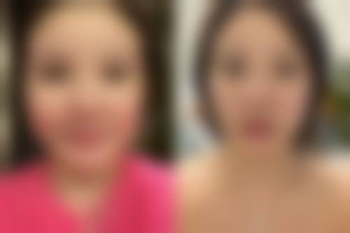 李逊医生项目优势