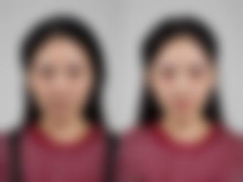 广州华医医疗美容门诊部顾客实例